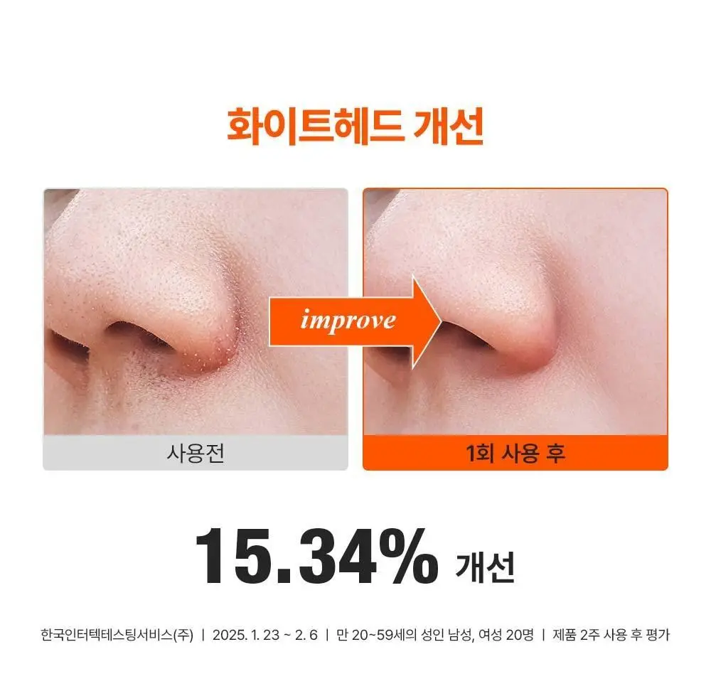 [단독기획] 런드리유 클린 포어 리퀴드 울트라 피지연화제 기획 (+피지전용화장솜 15매 증정) 상세페이지 26